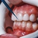 odontolove