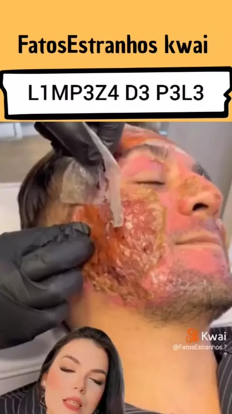Cp leaks videos